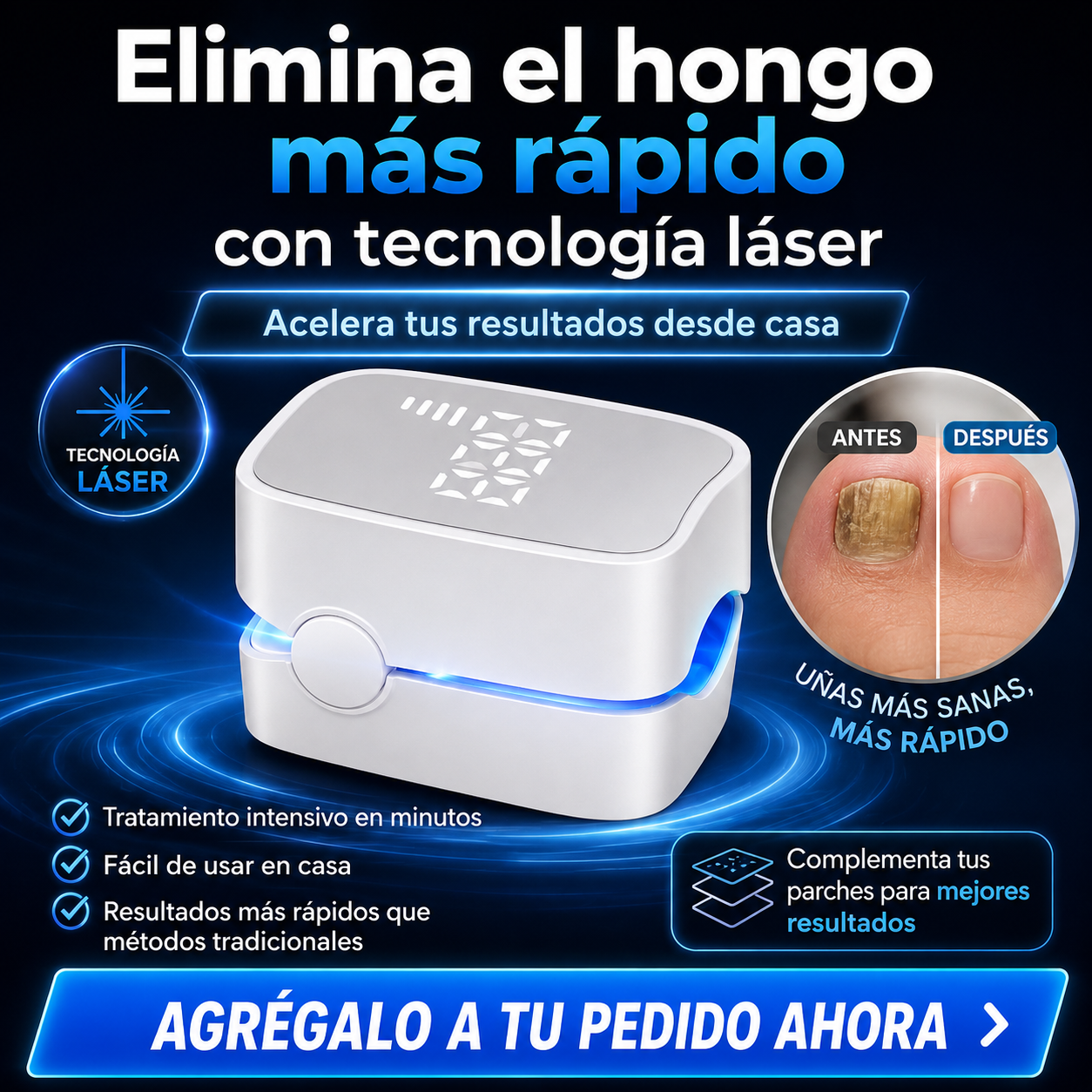 Laser De Hongos En Las Uñas