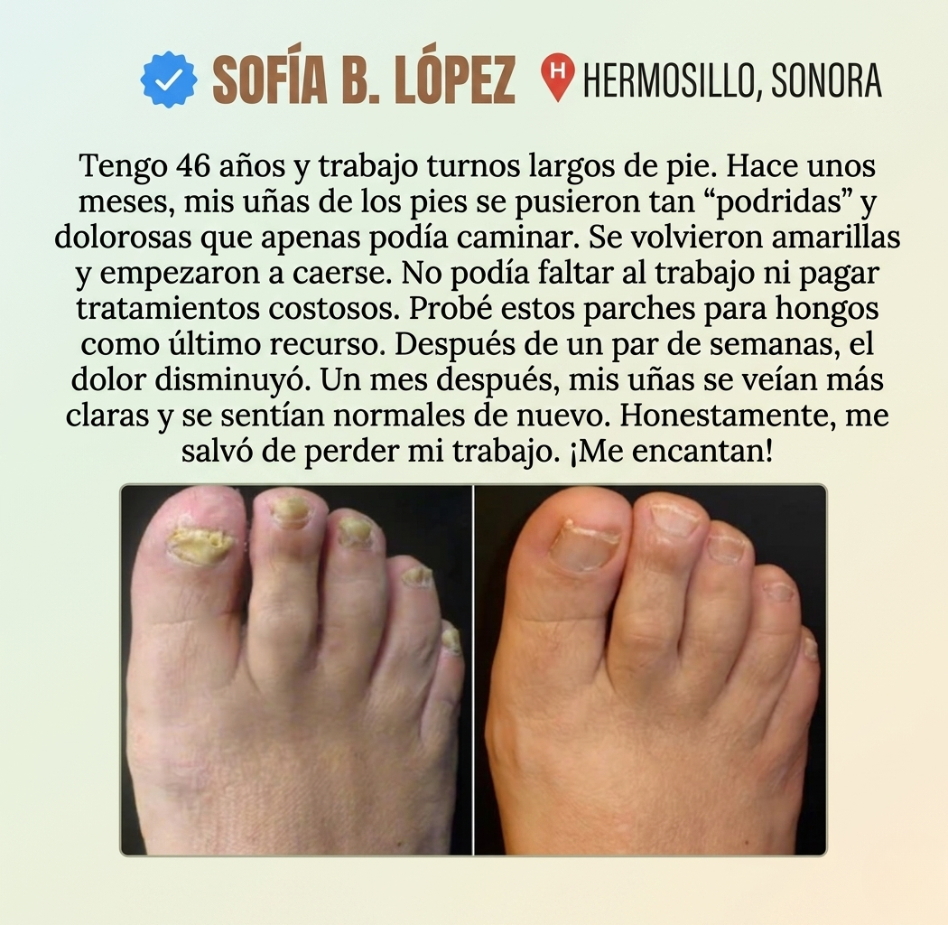 Parches Reparadores de Uñas con Hongos